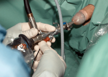 End Prostate Problem and Urination Troubles Fast!