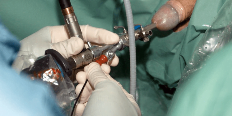 End Prostate Problem and Urination Troubles Fast!